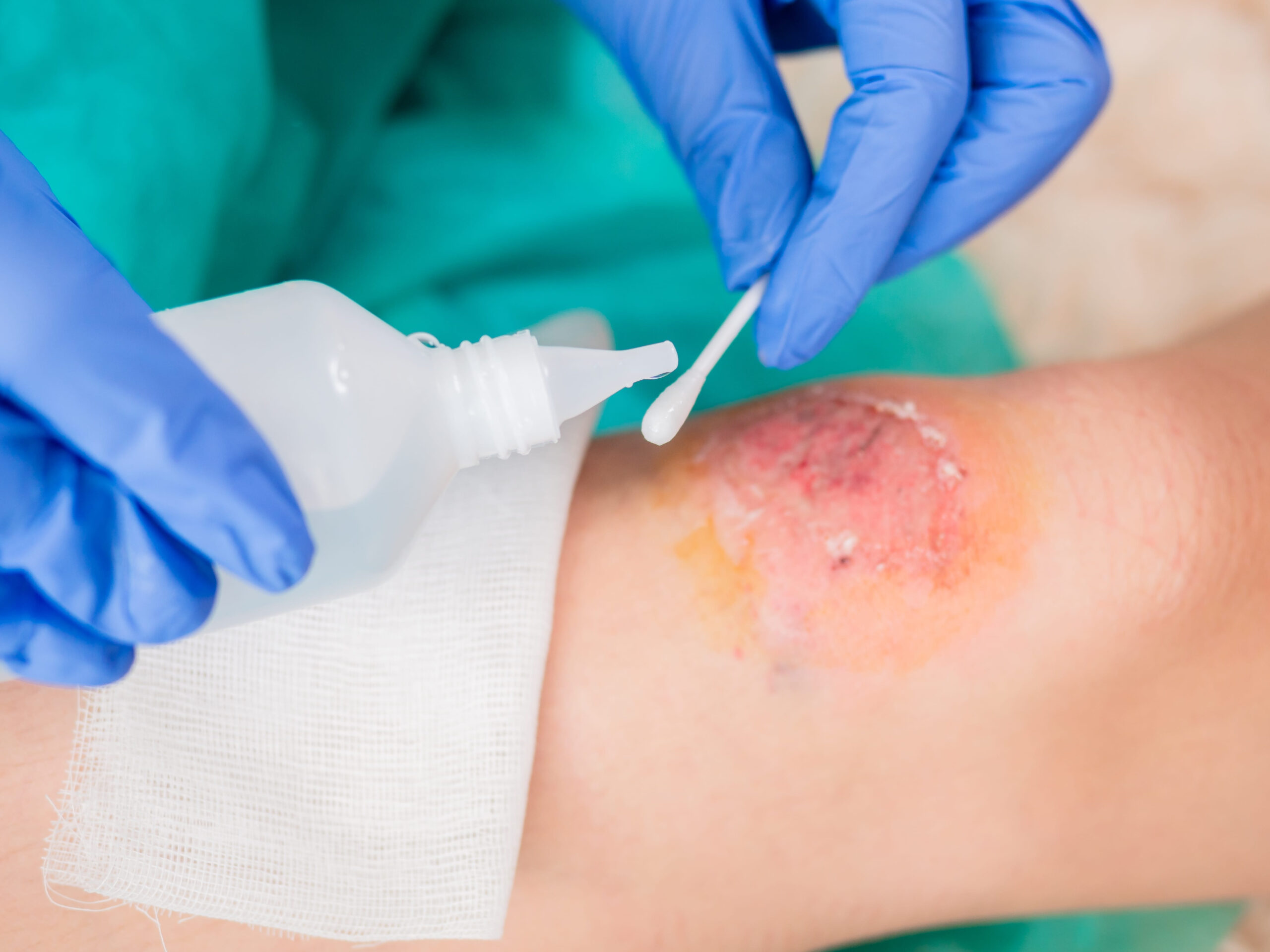 Bodily Fluid Clean-Up Procedure: A Step-by-Step Safety Guide